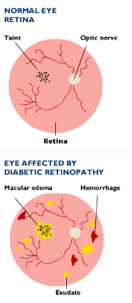 retinologist meaning